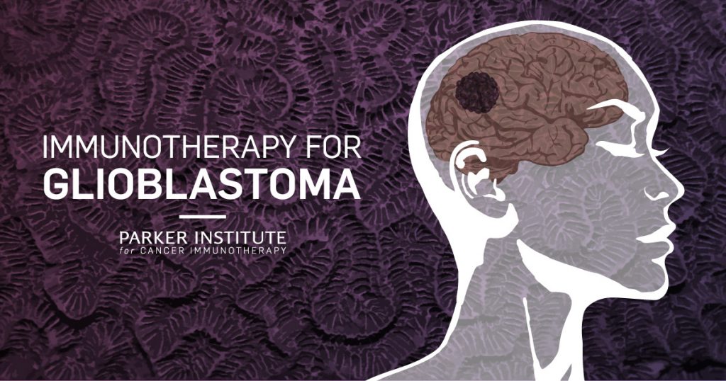 Immunotherapy for Glioblastoma - Parker Institute for Cancer Immunotherapy graphic