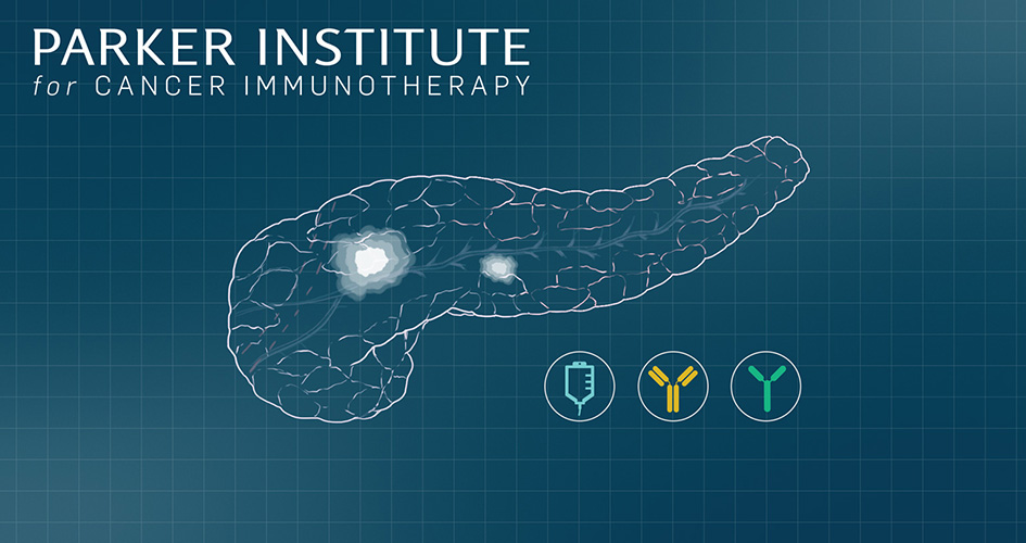 Parker Institute pancreatic cancer trial graphic